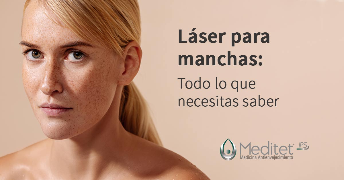 laser para manchas