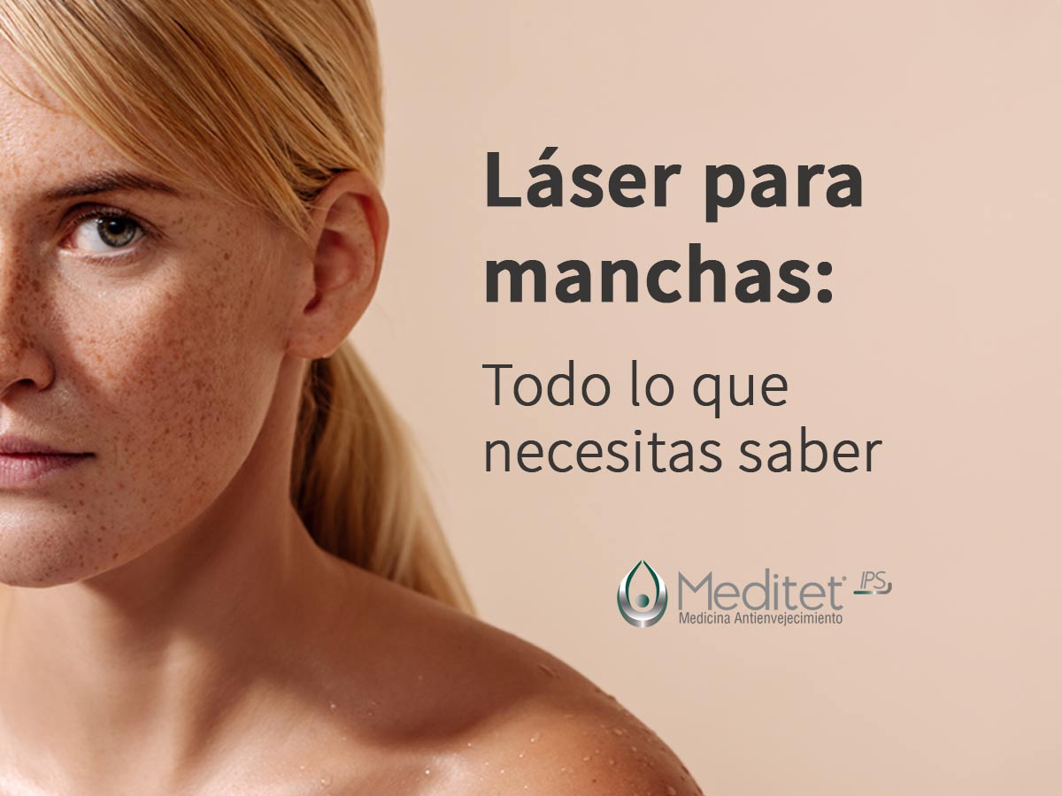 laser para manchas